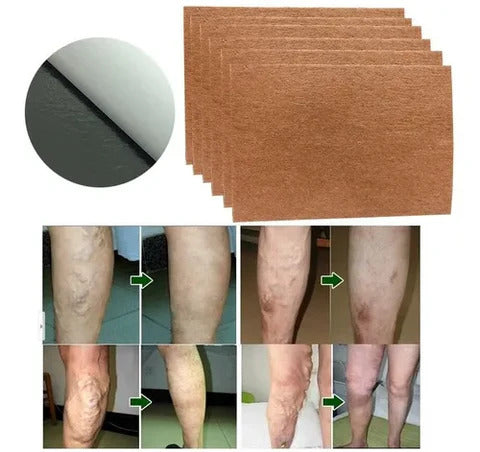 Packs de parches para eliminar las varices - Envío Gratis